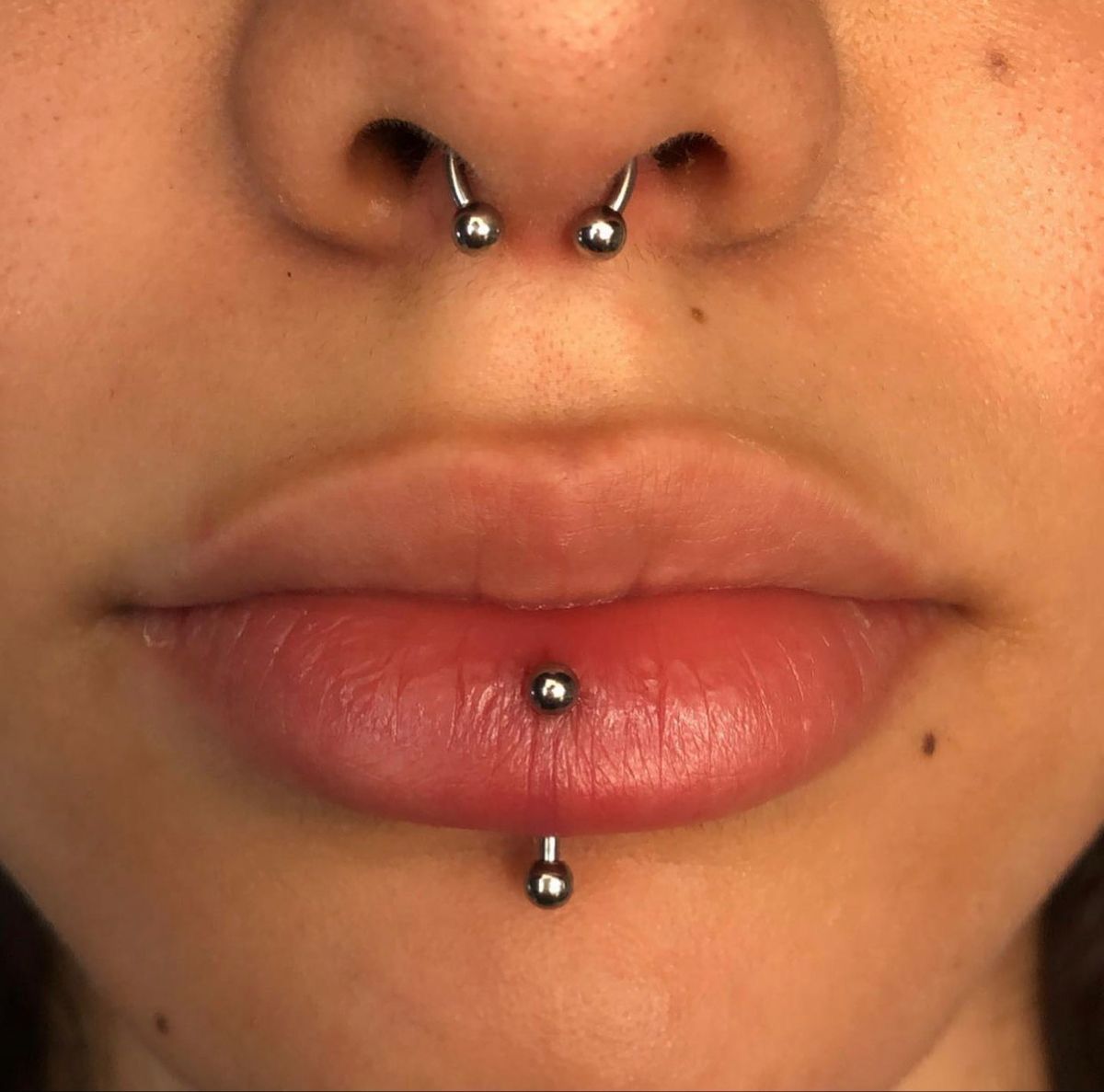 vertical labret healing