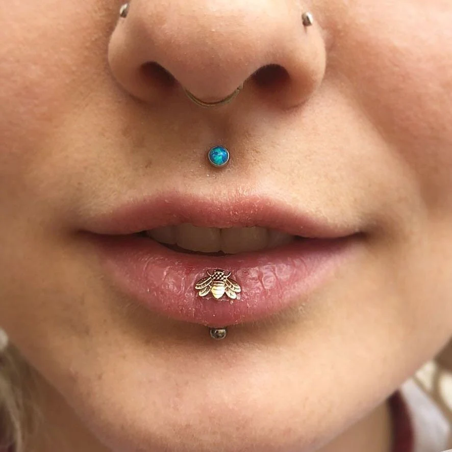 vertical labret healing